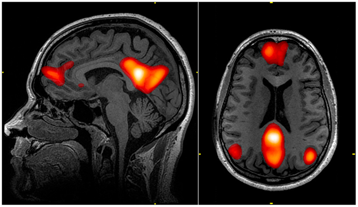 Mindfulness and the end of suffering: The Default Mode Network (DMN)